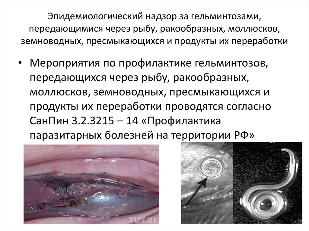 Эпидемиологический надзор за гельминтозами, передающимися через рыбу, ракообразных, моллюсков, земноводных, пресмыкающихся и