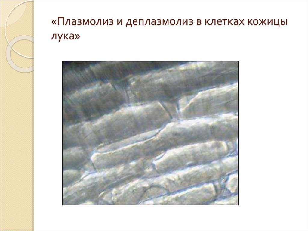 Плазмолиз. Плазмолиз и деплазмолиз в клетках. Деплазмолиз клетки лука под микроскопом. Плазмолиз деплазмолиз в клетках лука под микроскопом. Колпачковый плазмолиз в клетках кожицы лука.