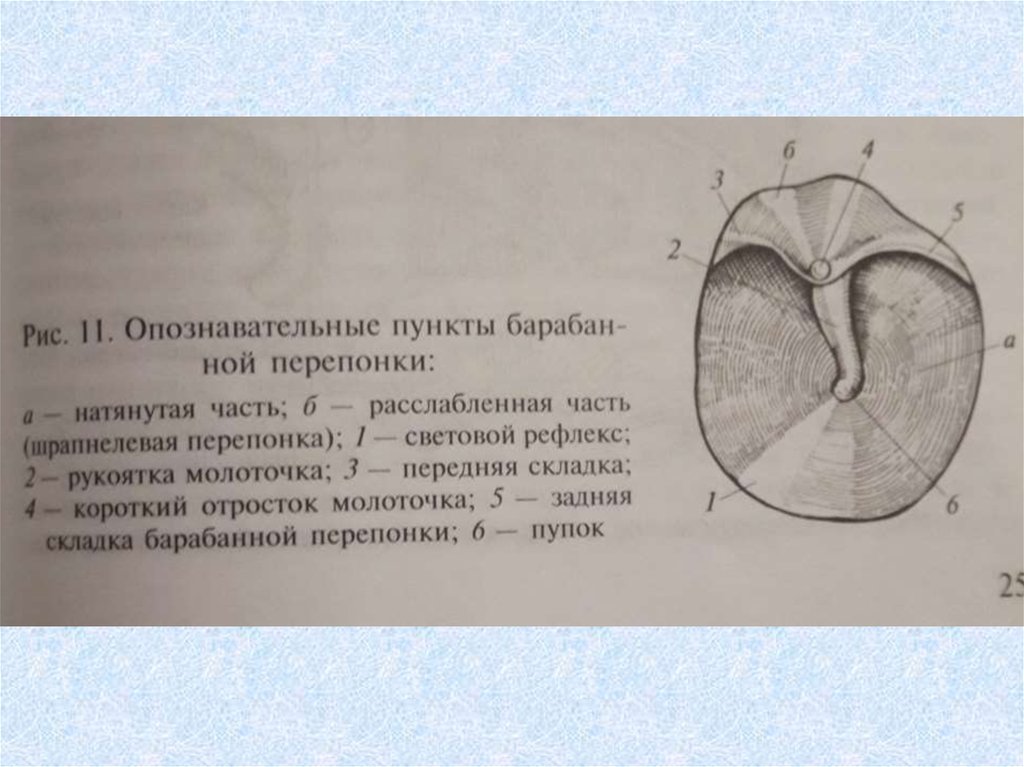 Квадранты барабанной перепонки рисунок