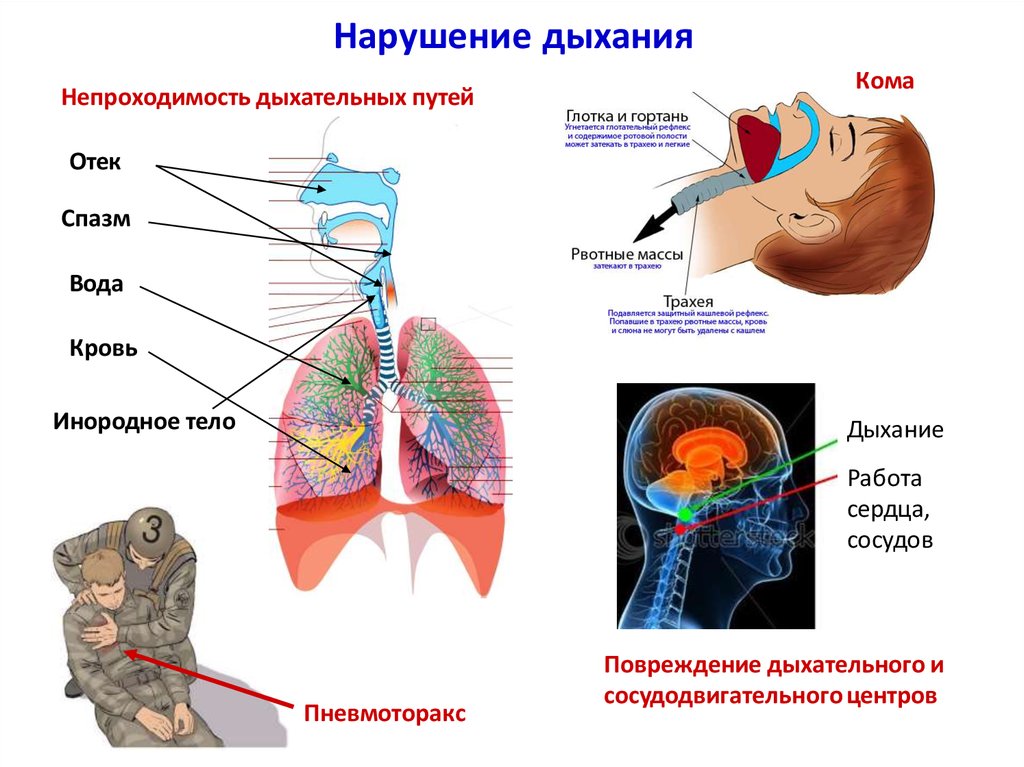 Нарушение дыхательной функции