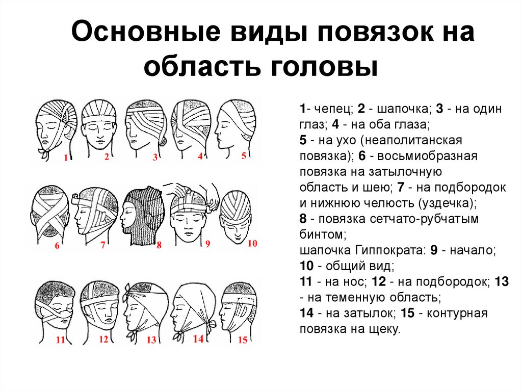    Основные виды повязок на область головы