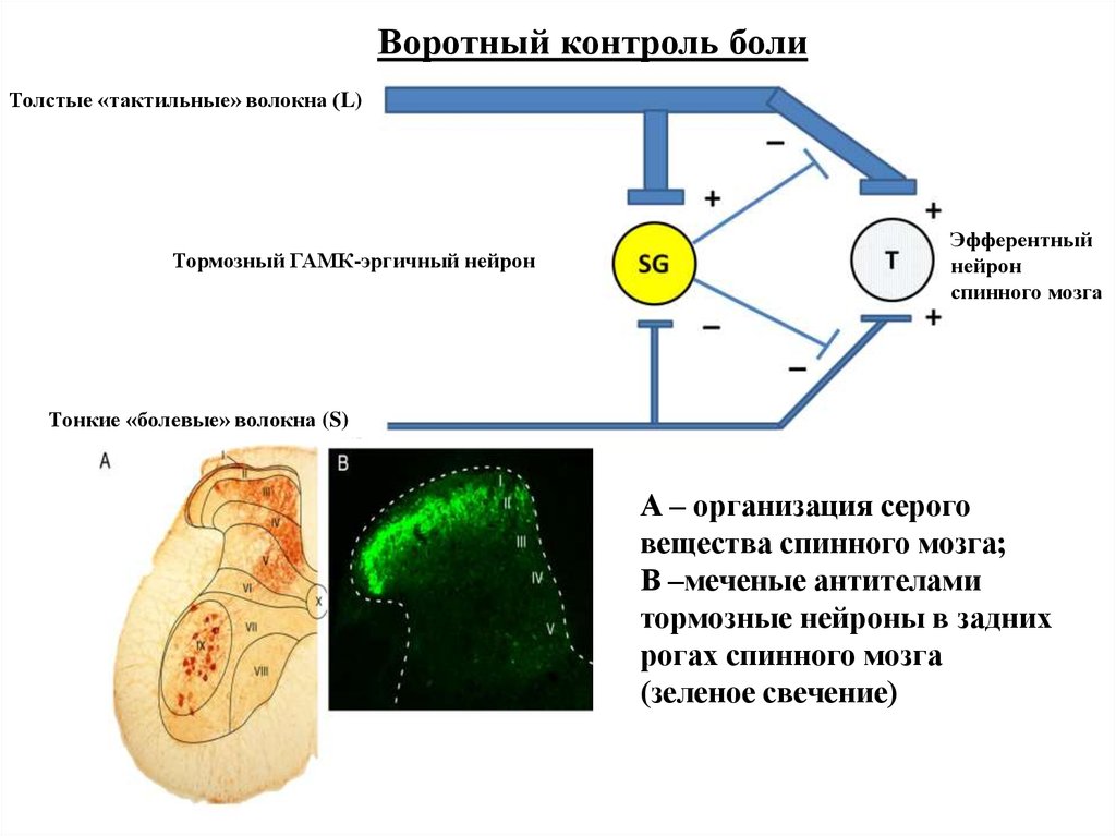 Теория воротного контроля формирования болевого ощущения презентация