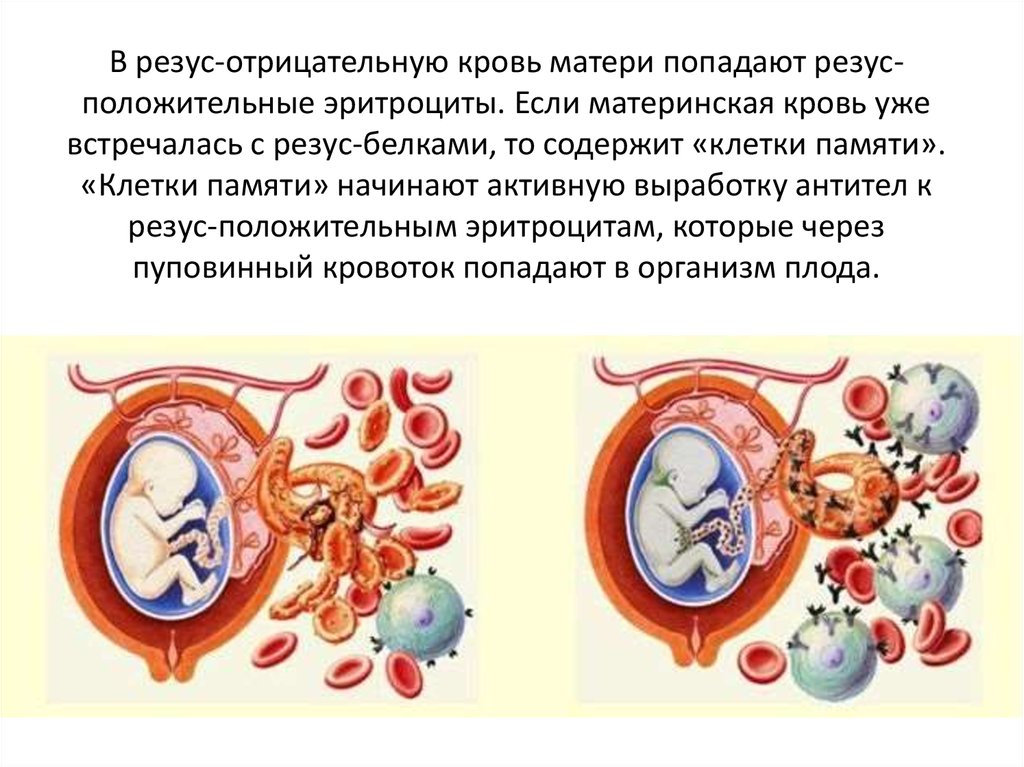 Первая отрицательная группа беременность. Резус-фактор крови отрицательный. Резузотрицательнаякровь. Резус отрицательная кровь. Отрицательный и положительный резус крови.
