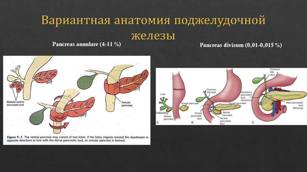 Удаляют ли поджелудочную железу полностью. Формы поджелудочной железы. Анатомия поджелудочной железы Синельников. Вариантная анатомия поджелудочной железы. Поджелудочная железа формы строения.