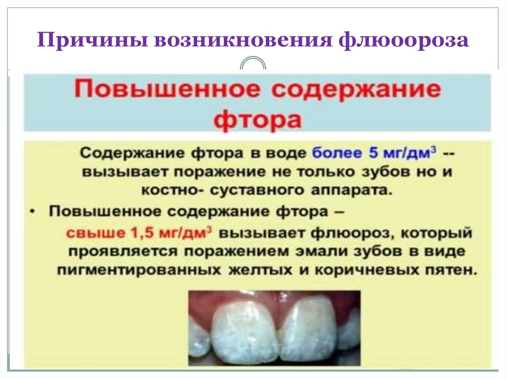 Раствор фтора в воде. Влияние фторид-Иона на эмаль зубов. Влияние фтора на эмаль зубов.