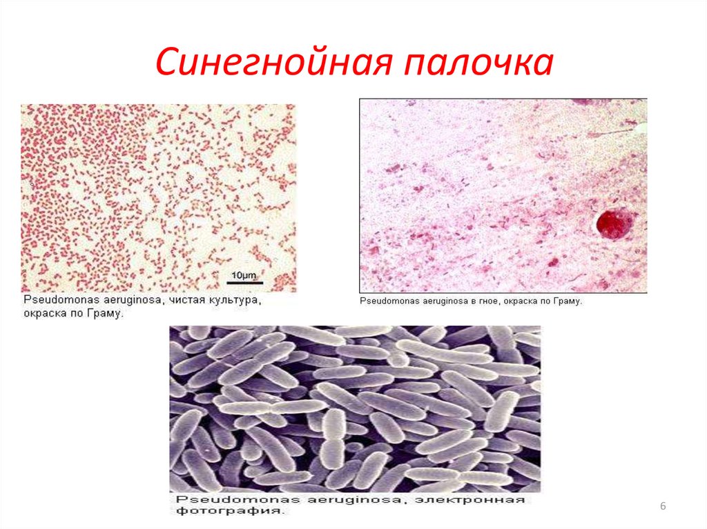 Pseudomonas aeruginosa. Окраска по Граму синегнойной палочки. Синегнойная палочка микроскопия. Синегнойная палочка микроскопия по Граму. Pseudomonas aeruginosa микроскопия.