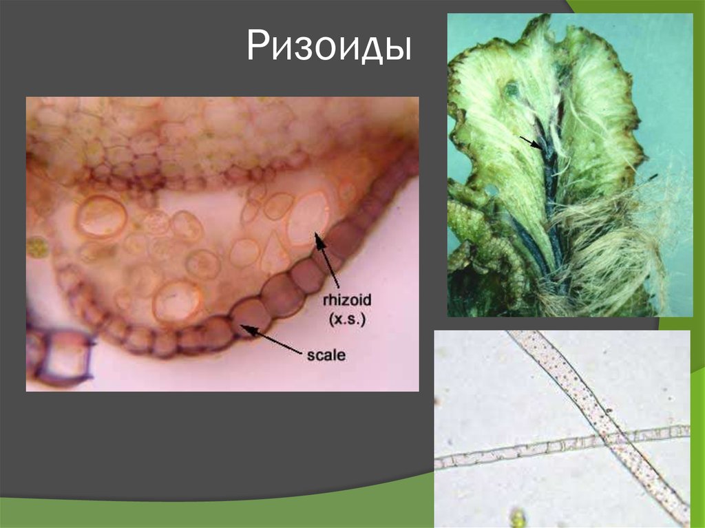 Ризоиды это. Ризоиды. Ризоиды строение. Ризоиды это в биологии.