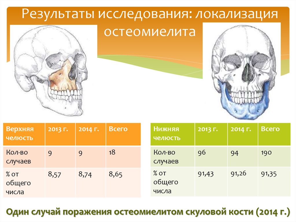 Результаты исследования: локализация остеомиелита