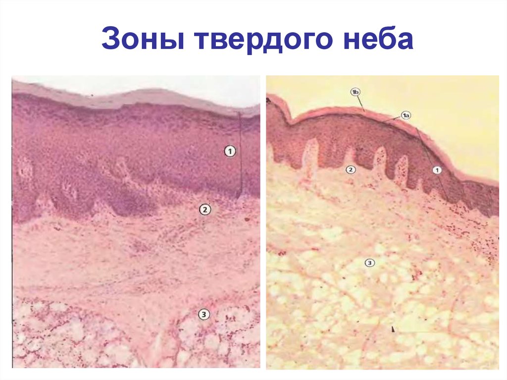 Неба зон. Твердое небо гистология препарат. Строение твердого неба гистология. Зоны твердого неба гистология. Мягкое небо гистология.