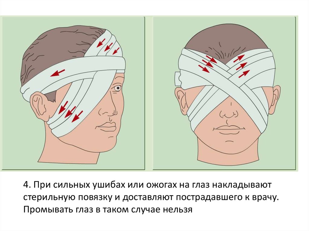 Первая помощь при травмах глаз - презентация онлайн