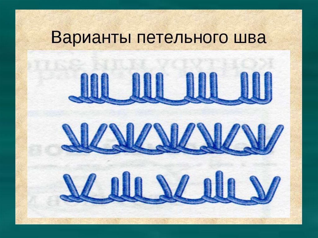 Строчка петельного стежка презентация 3 класс презентация