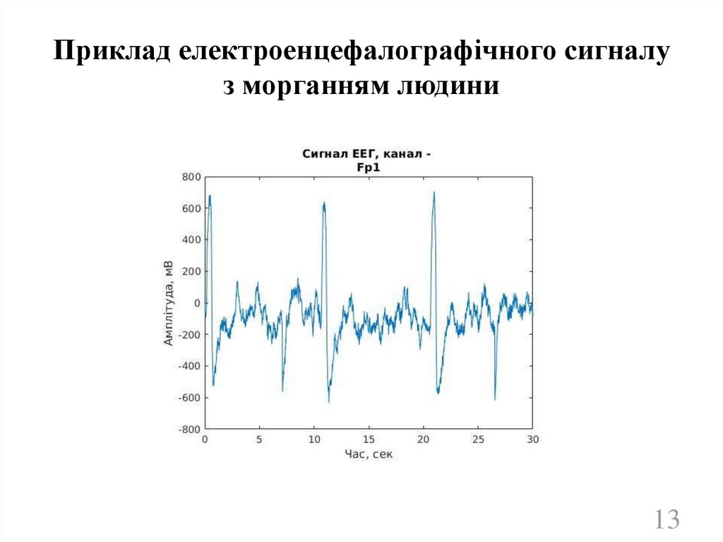 Приклад електроенцефалографічного сигналу з морганням людини