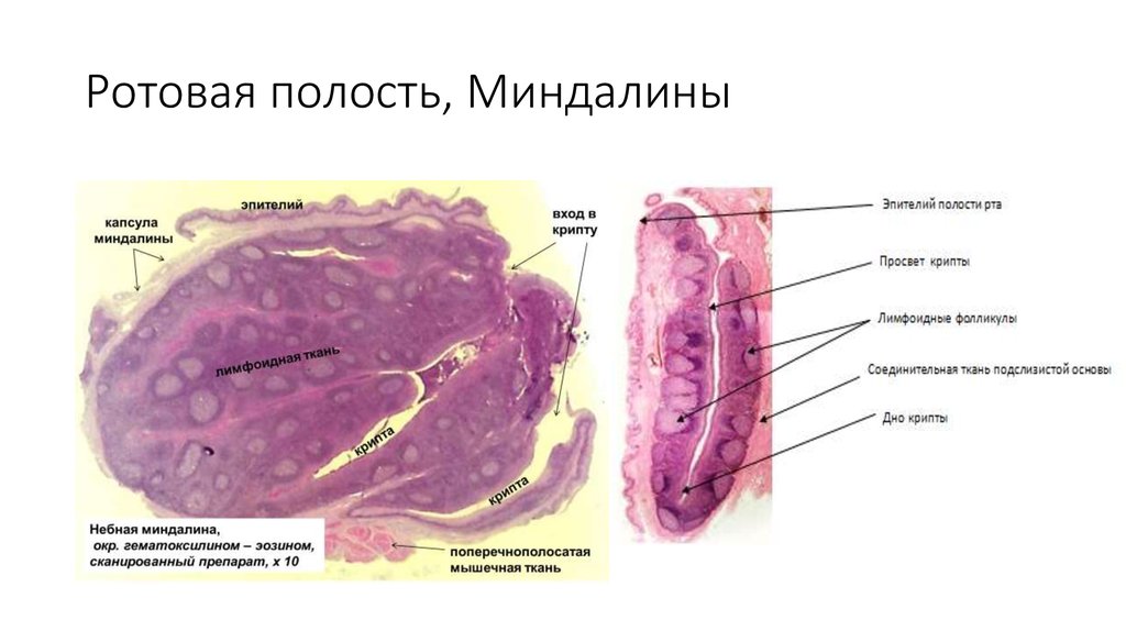 Миндалина гистология рисунок