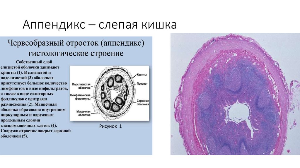 Особенности аппендикса. Аппендикулярный отросток гистология. Червеобразный отросток гистология. Гистологический препарат червеобразный отросток. Аппендикс гистология препарат.