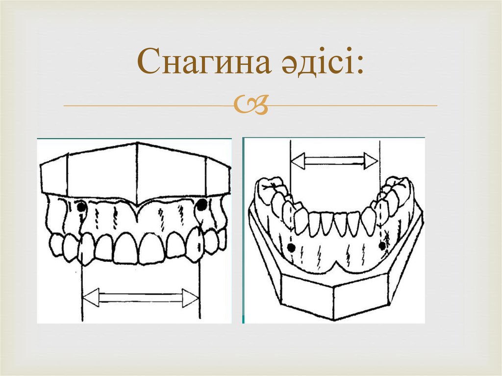 Снагина әдісі:
