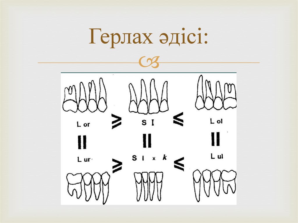 Герлаx әдісі: