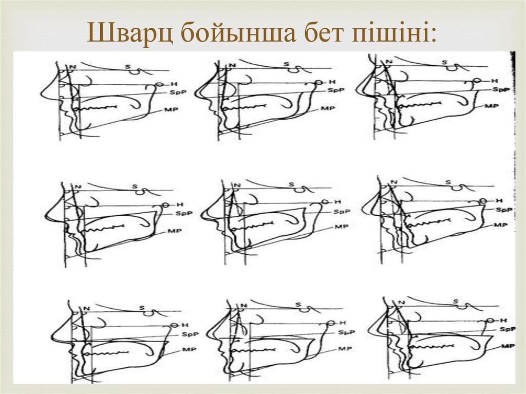 Шварц бойынша бет пішіні: