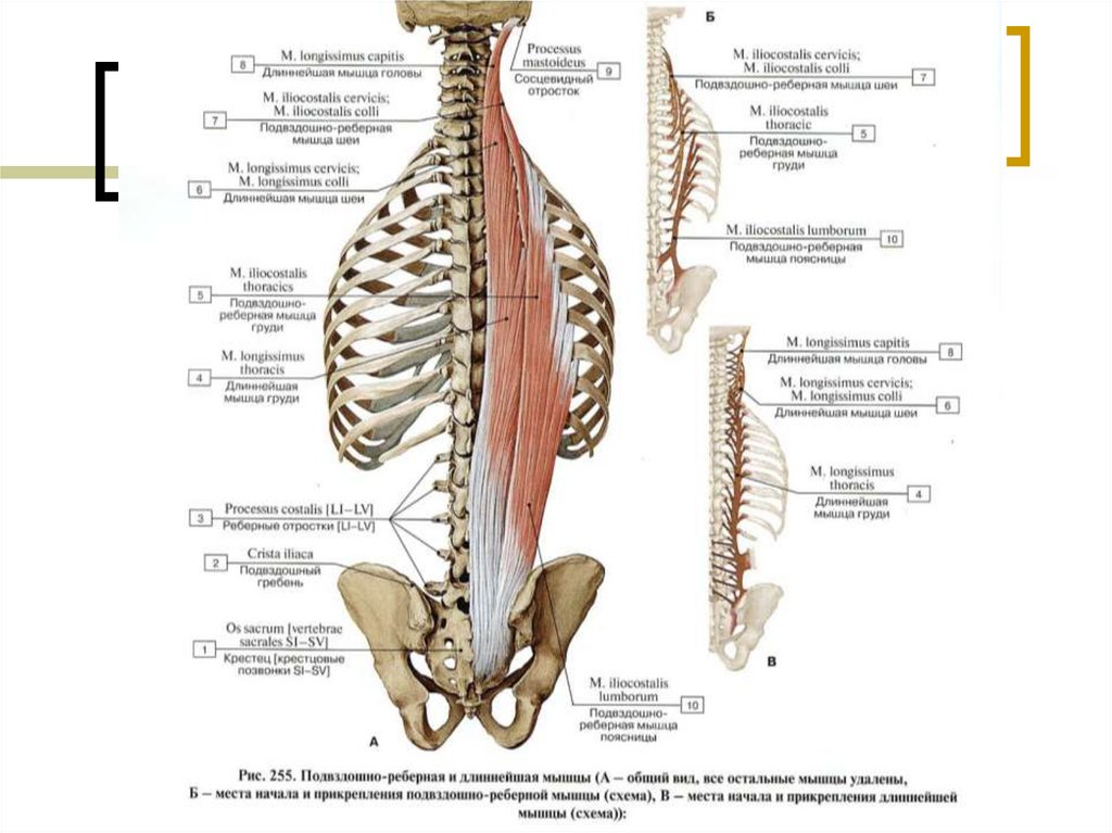 Поясничный отдел мышцы спины. Longissimus Thoracis. M iliocostalis Lumborum. Длиннейшая мышца (m. longissimus). Мускулюс лонгиссимус.