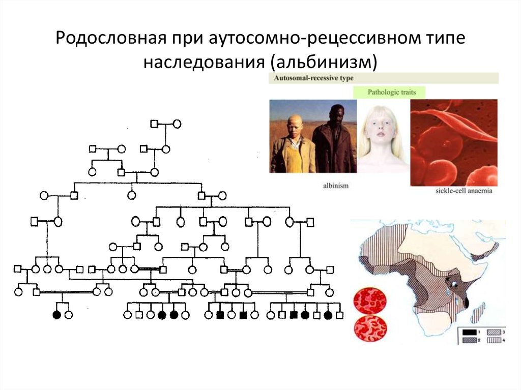 Аутосомно рецессивные наследственные заболевания. Аутосомно-рецессивный Тип родословная. Аутосомно-рецессивный Тип наследования альбинизма. Альбинизм генетика схема. Альбинизм Тип наследования.