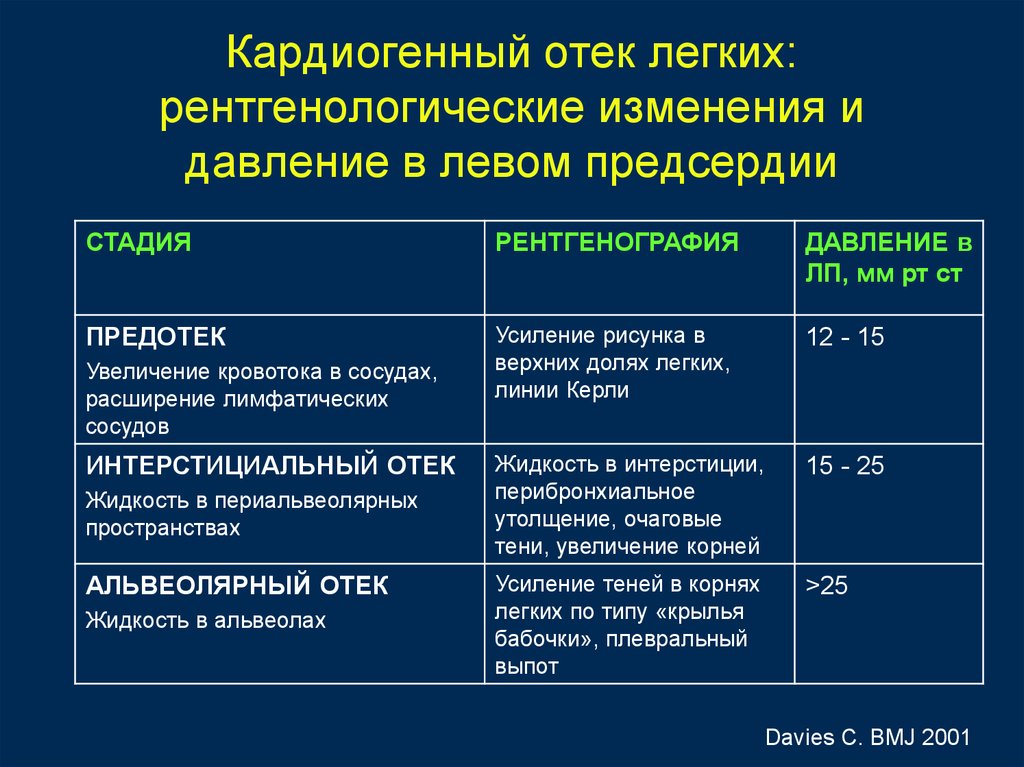 Кардиогенная сердечная недостаточность. Стадии кардиогенного отека легких. Отек легких диагностические критерии. Этапы развития отека легких. Кардиогенный отек.