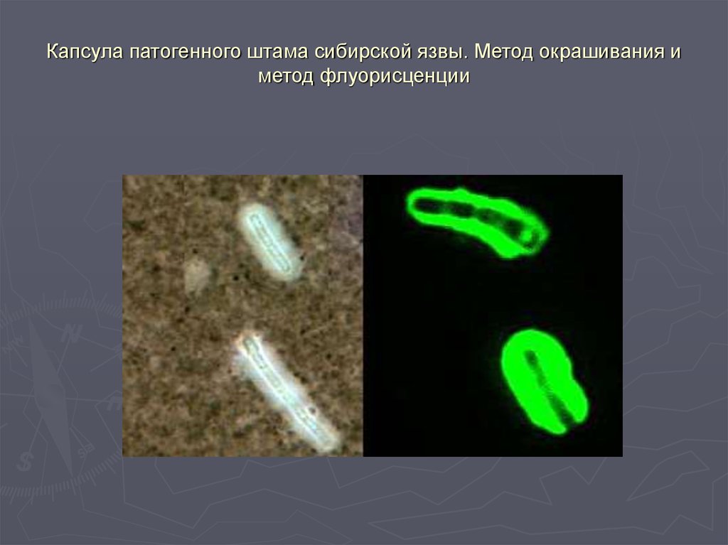 Патологоанатомическая картина при сибирской язве представлена всеми описанными изменениями кроме