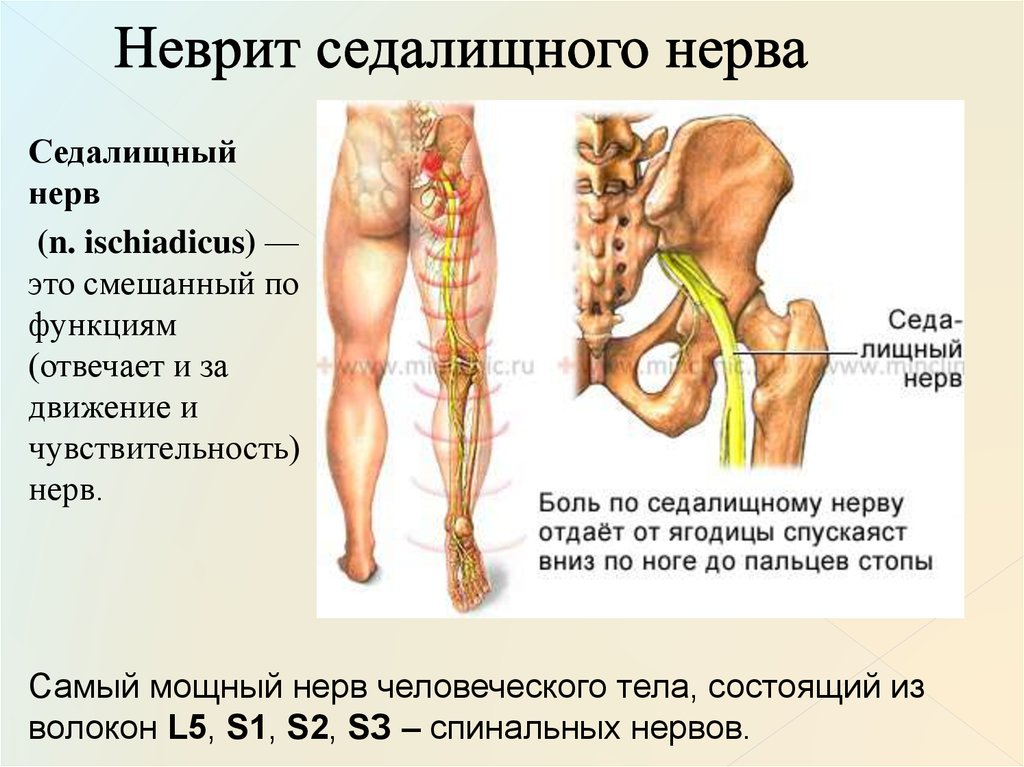 Поясница нога отнимается. Повреждение седалищного нерва симптомы. Нерв ноги болит седалищный симптомы. Защемление седалищного седалищного нерва симптомы. Невропатия седалищного нерва.
