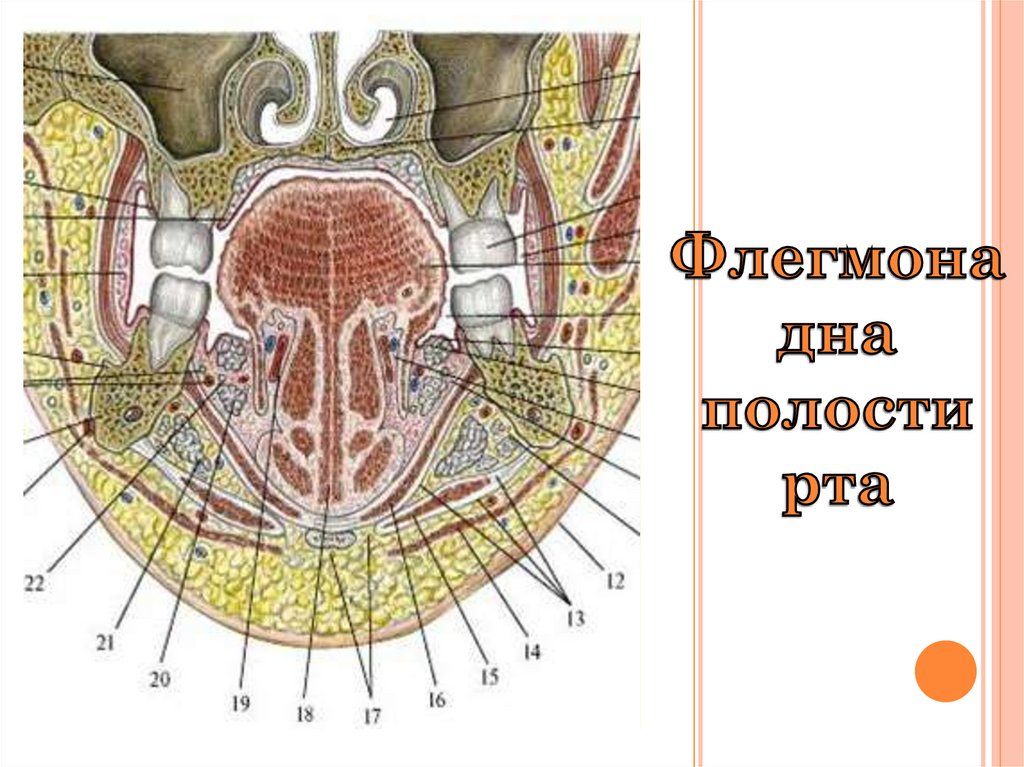 Пространства полости рта. Клетчаточные пространства дна ротовой полости. Флегмона дна ротовой полости. Латеральное клетчаточное пространство дна полости рта. Клетчаточное пространство дна полости рта анатомия.