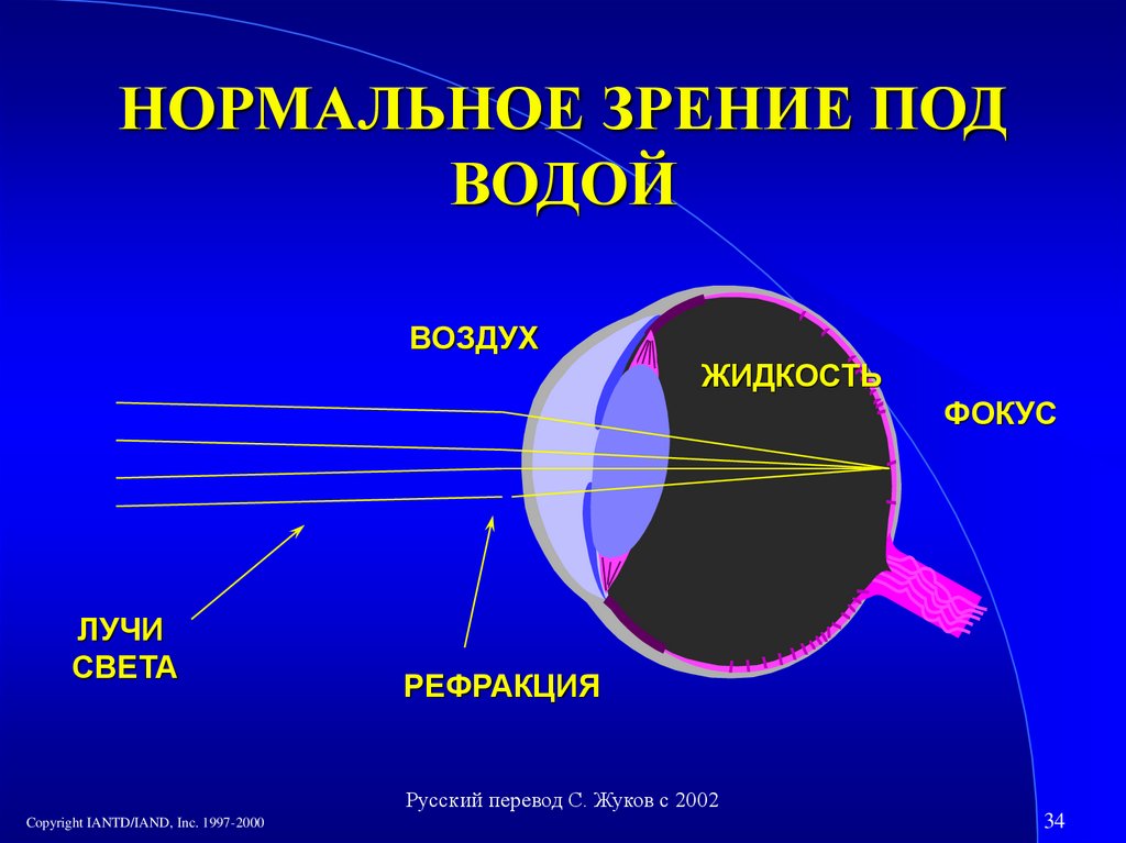 Нормальное зрение. Зрение под водой. Фокус зрения. Зрение под водой физика преломление.