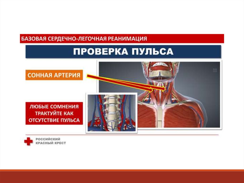 Базовая слр презентация