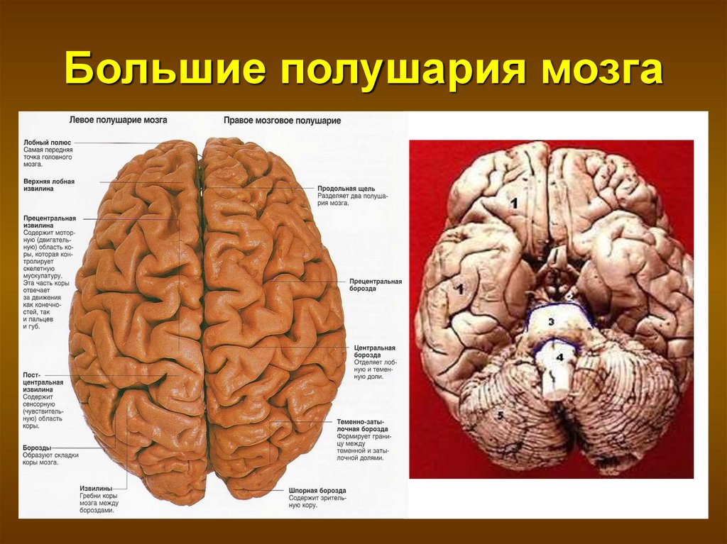 В переднем мозге полушария отсутствуют. Полушария мозга. Большие полушария. Полушария большого мозга. Левое полушарие большого мозга.