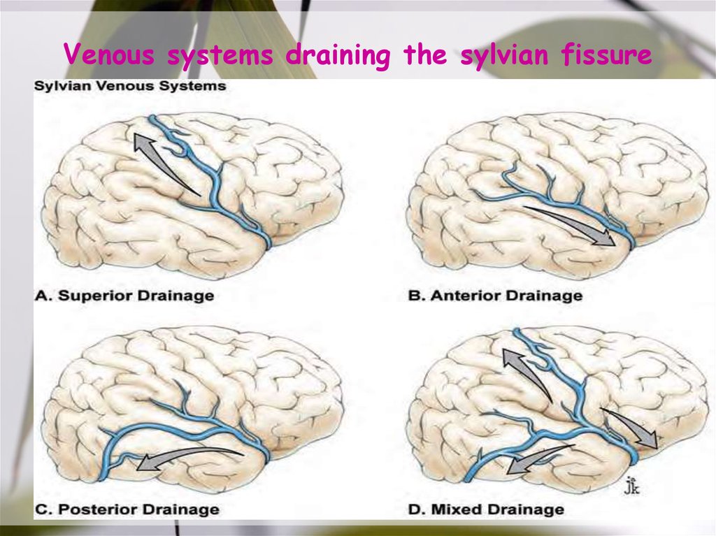 Sylvian Fissure Anatomy