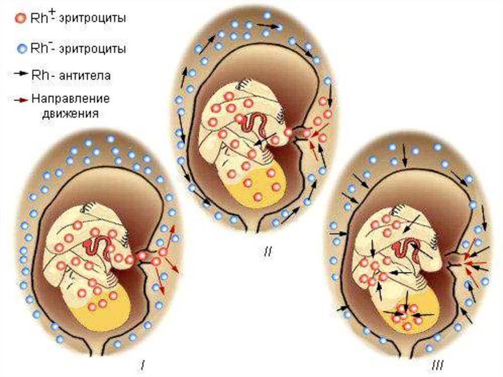 Резус матери и ребенка. Резус конфликт в акушерской практике. Условия резус-конфликта в акушерской практике. Чение резус фактора в акушерской практике..