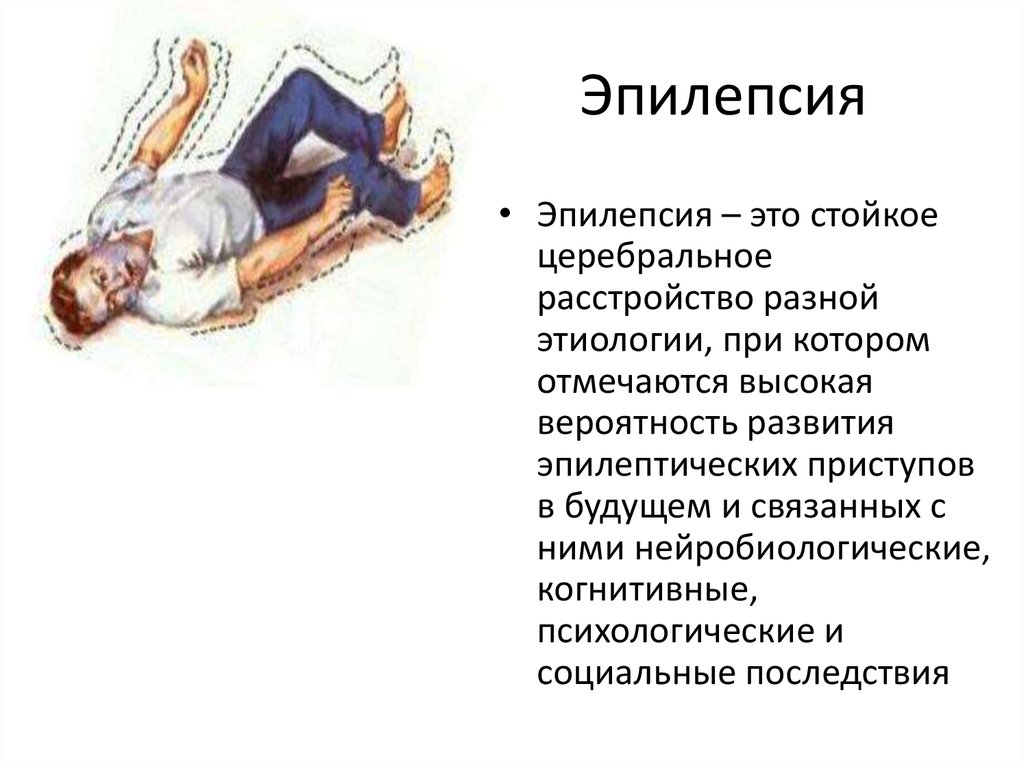 эпилепсия