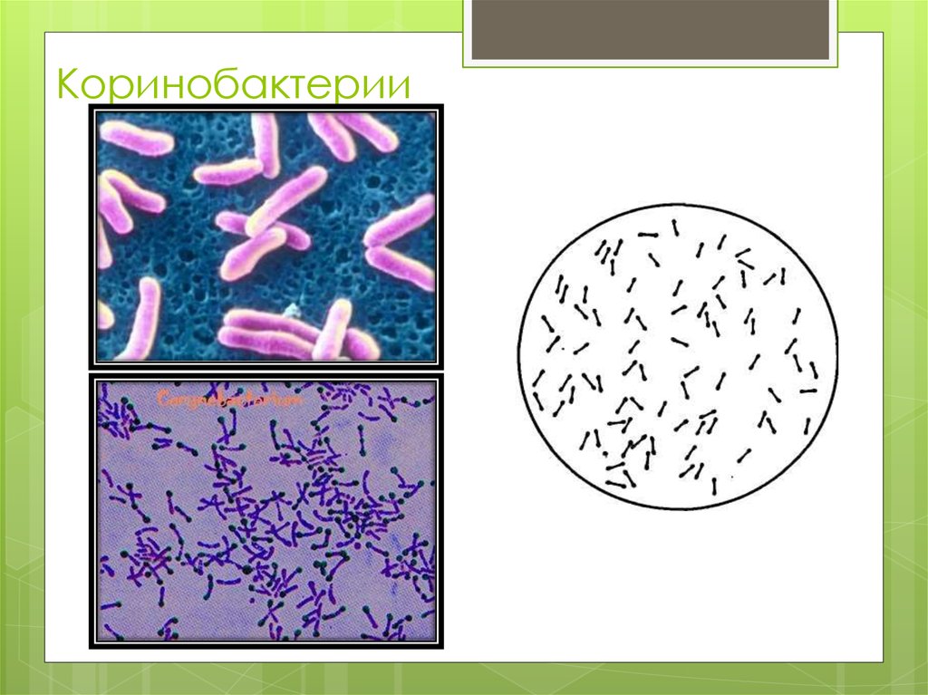 Коринобактерии в мазке на флору у женщин фото