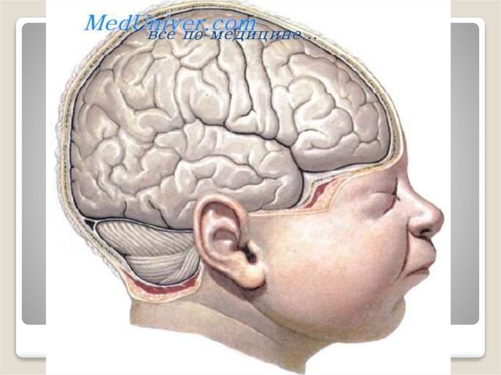 Заболевание головного мозга у детей