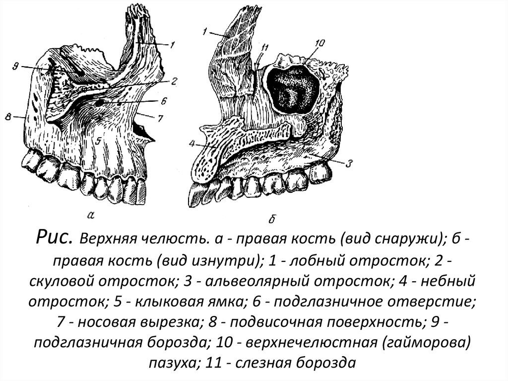 Клыковой ямки. Небный отросток верхнечелюстной кости. Верхняя челюсть анатомия строение. Верхняя челюсть кость. Верхняя челюстная кость анатомия.