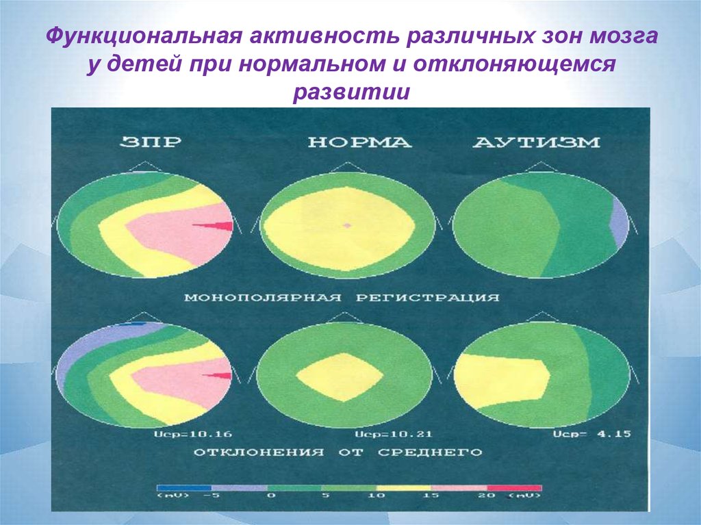 Различные зоны. Функциональная активность. Инструментальная функциональная активность. Функционально активные. Уровни функциональной активности НС.