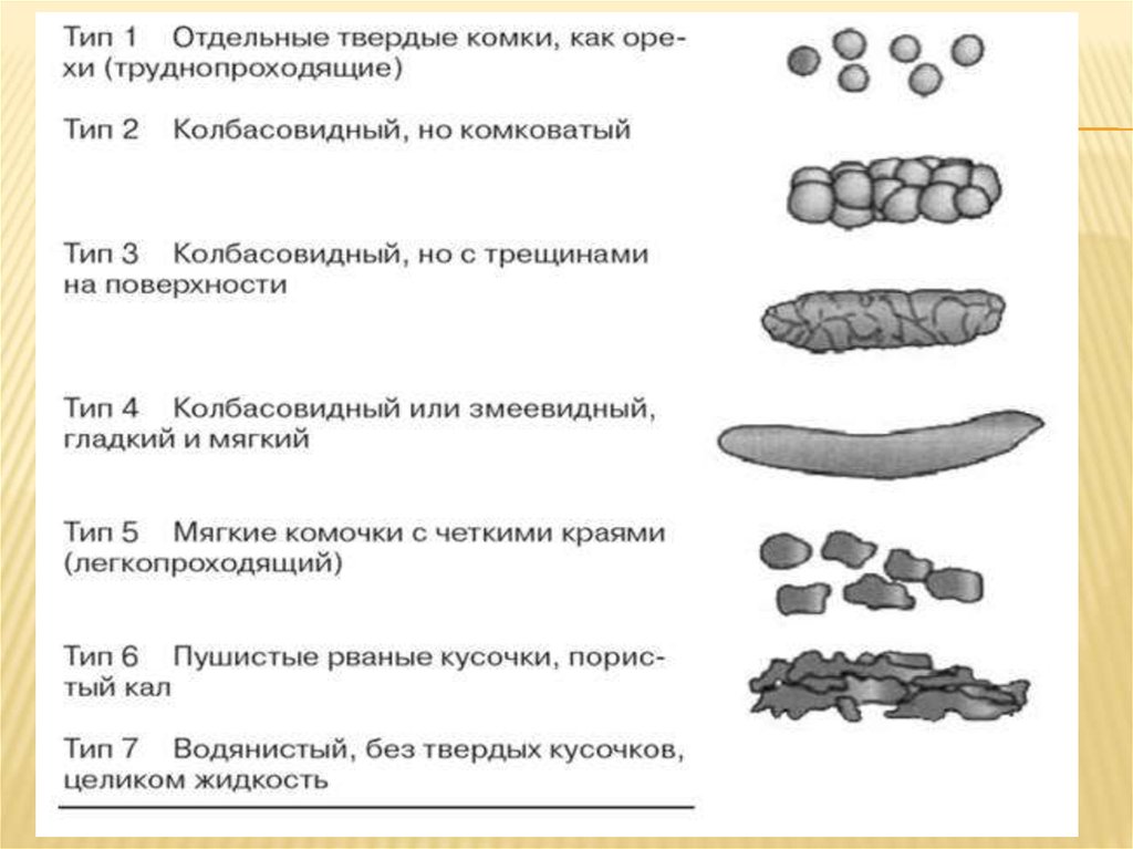 Каловые камни каши