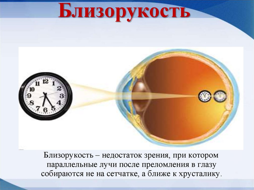 Презентация глаз как оптическая система 9 класс