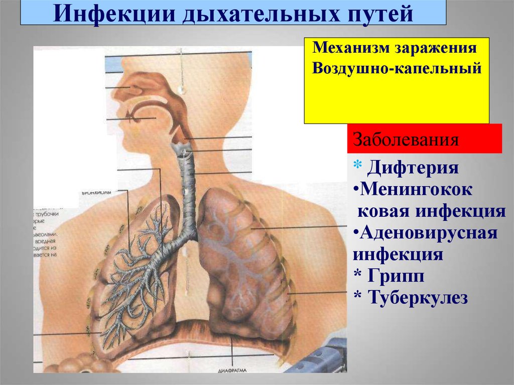 Болезни дыхательных путей. Заболевания дыхательных путей. Инфекционные заболевания дых путей. Респираторные инфекции дыхательных путей. Инфекционные болезни дыхательных путей.