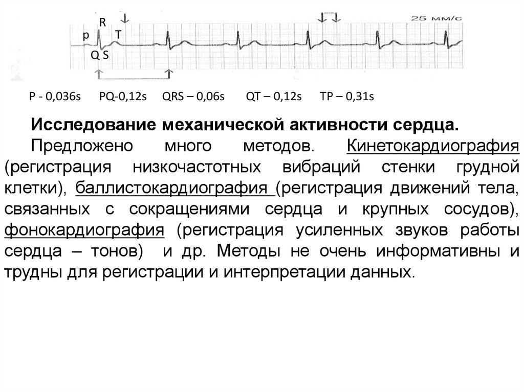 Функциональная сердечно сосудистая. Функциональная диагностика сердечно-сосудистой системы. Баллистокардиография физиология. Баллистокардиография методика регистрации. Баллистокардиография животных.