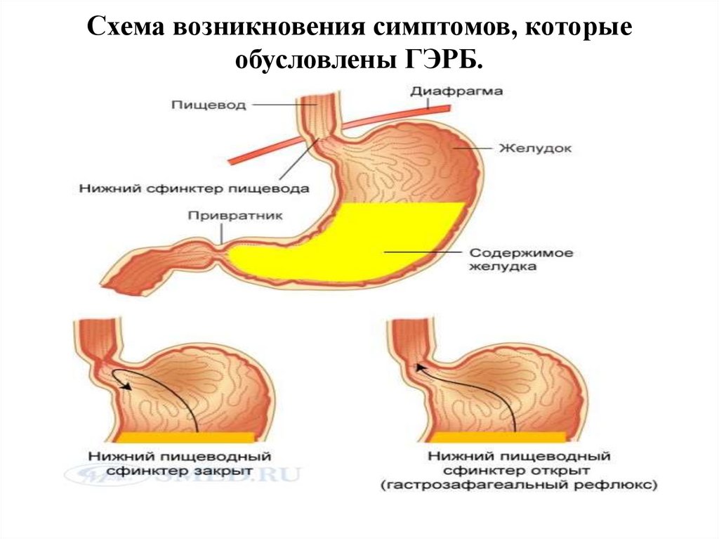 Гэрб симптомы