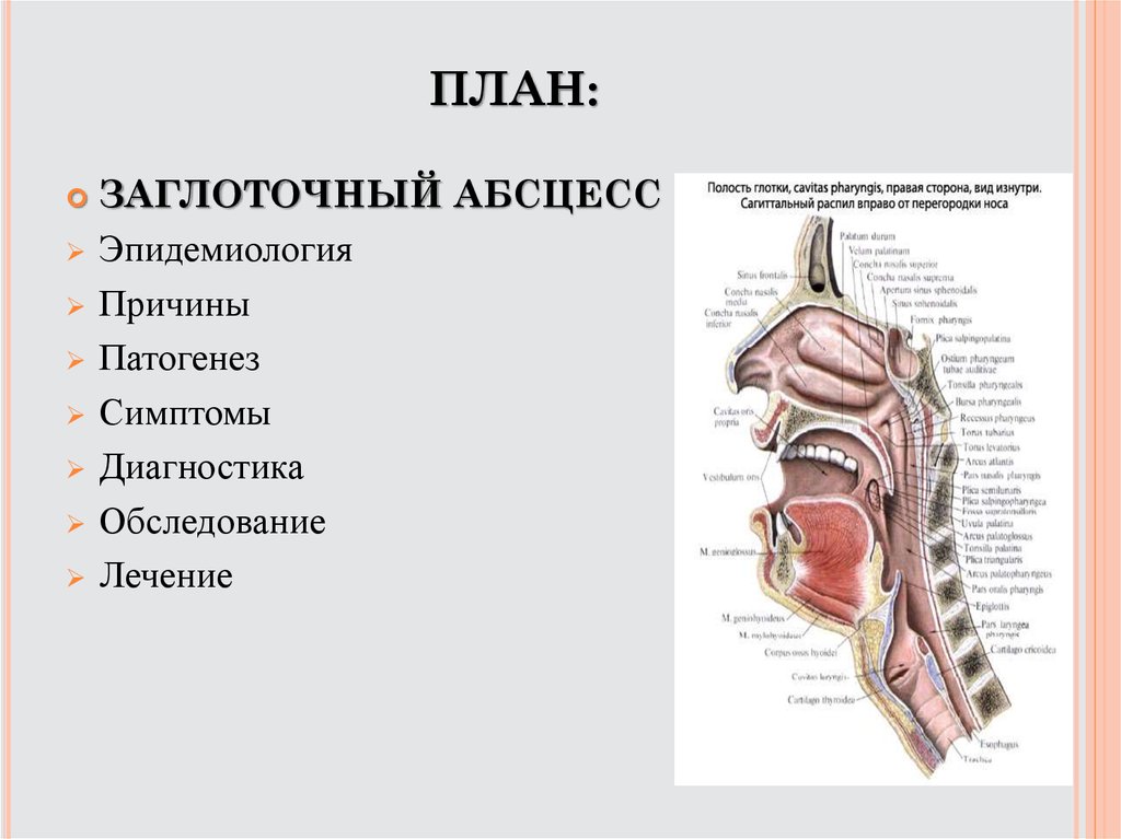 Заглоточный абсцесс. Назофарингеальный заглоточный абсцесс. Заглоточный абсцесс выбухание. Ретрофарингеальный абсцесс этиология. Заглоточный абсцесс атлас.