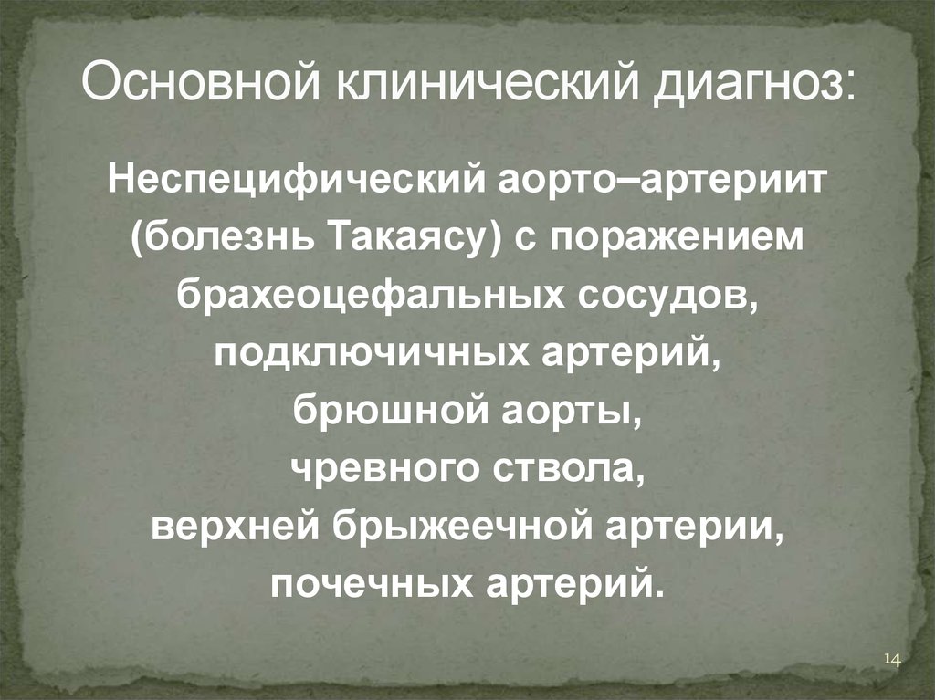 Для болезни такаясу характерно наличие в клинической картине