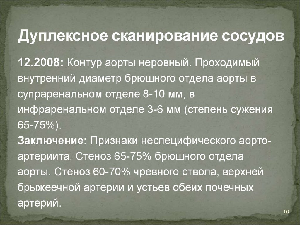 Для болезни такаясу характерно наличие в клинической картине