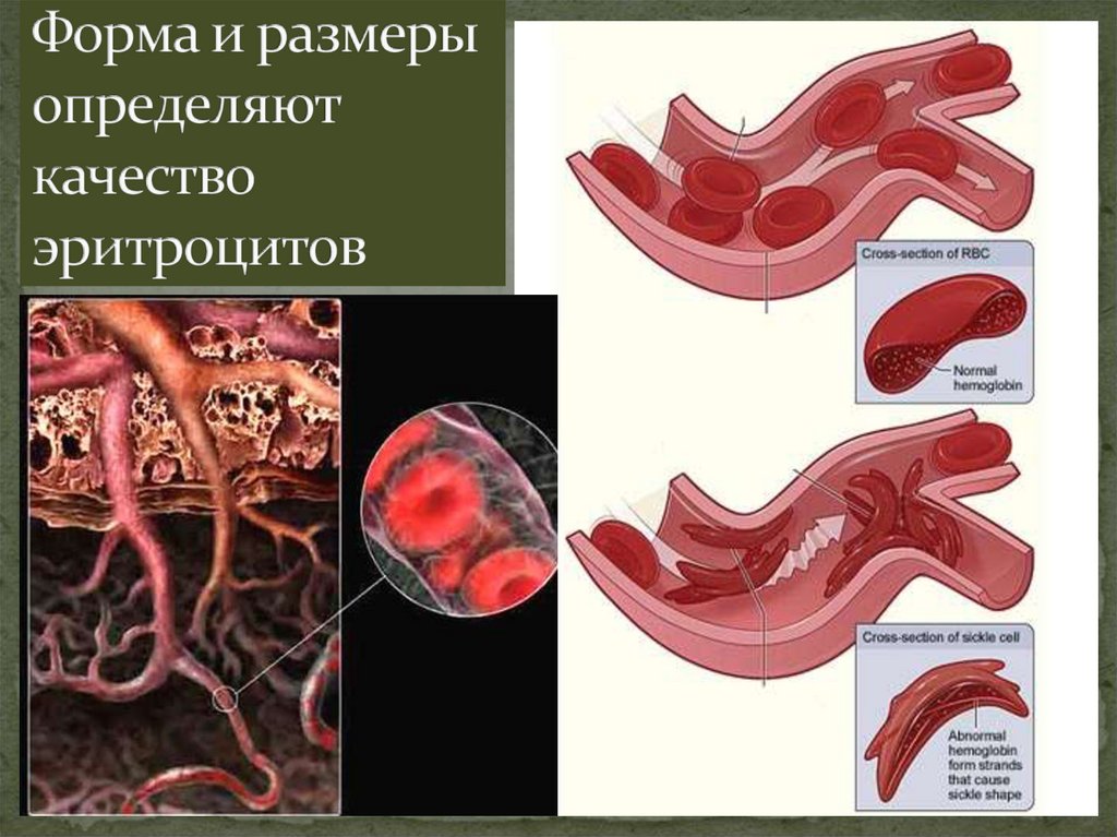Форма и размеры определяют качество эритроцитов