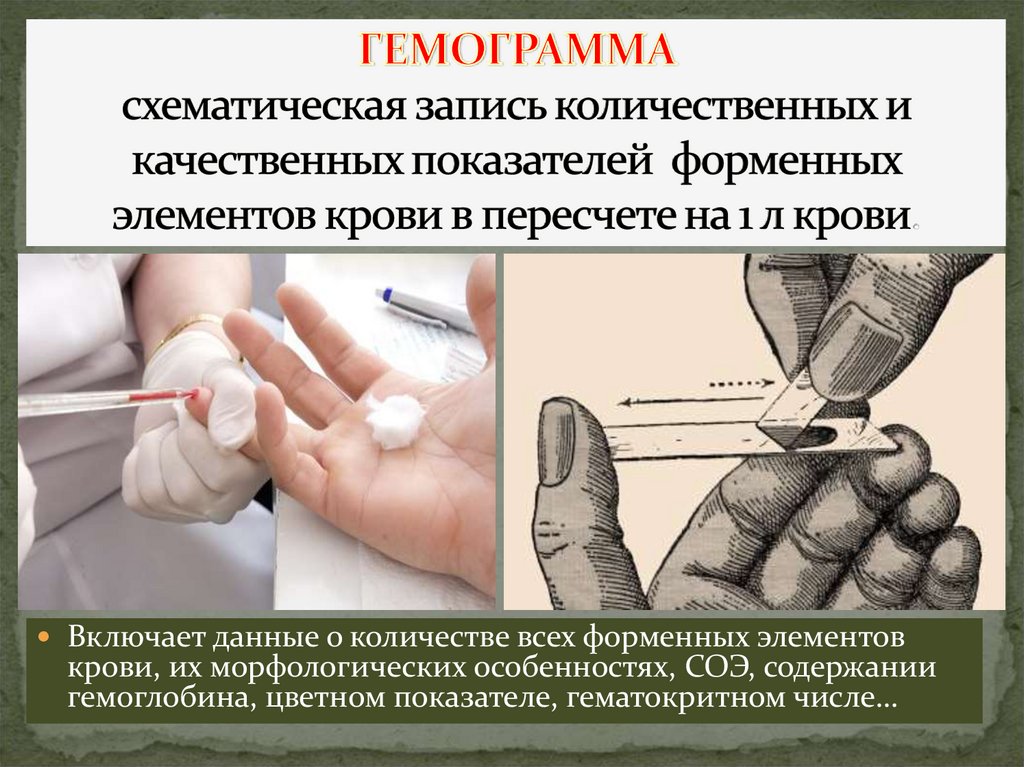 ГЕМОГРАММА схематическая запись количественных и качественных показателей форменных элементов крови в пересчете на 1 л крови.