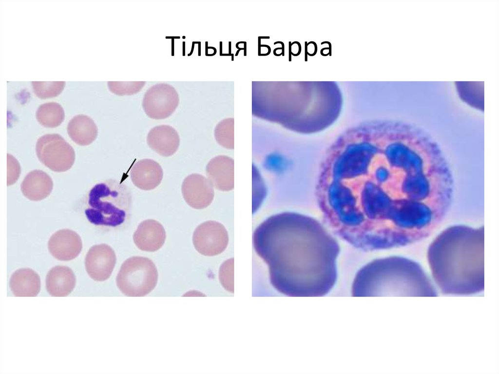 Тільця Барра