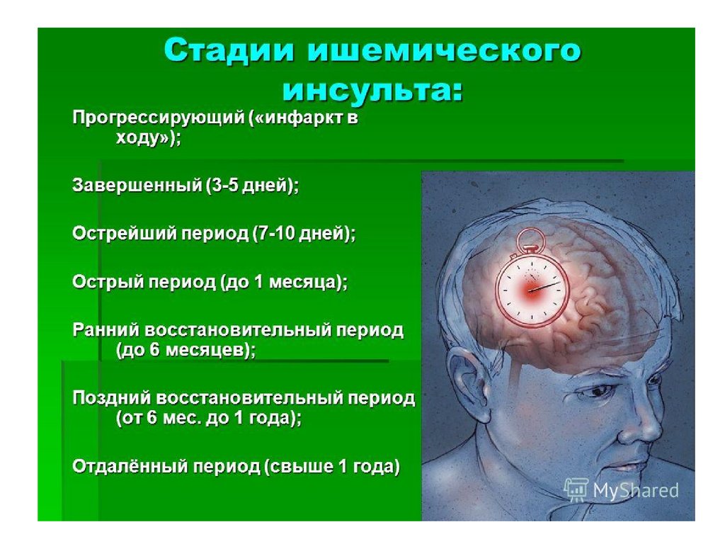 Признаки заболевания мозга. Ишемический инсульт мозга. После ишемического инсульта.