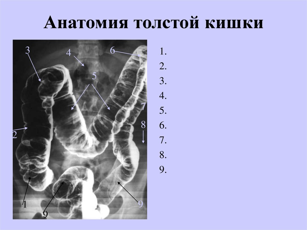 Слепая и ободочная кишка. Ободочная кишка рентген анатомия. Рентген анатомия Толстого кишечника. Опухоль сигмовидной кишки рентген. Селезеночный угол ободочной кишки.